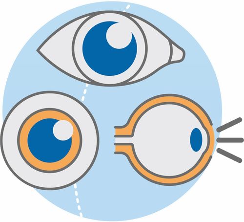 如何才能准确验光配镜？这些计量知识你一定要知道